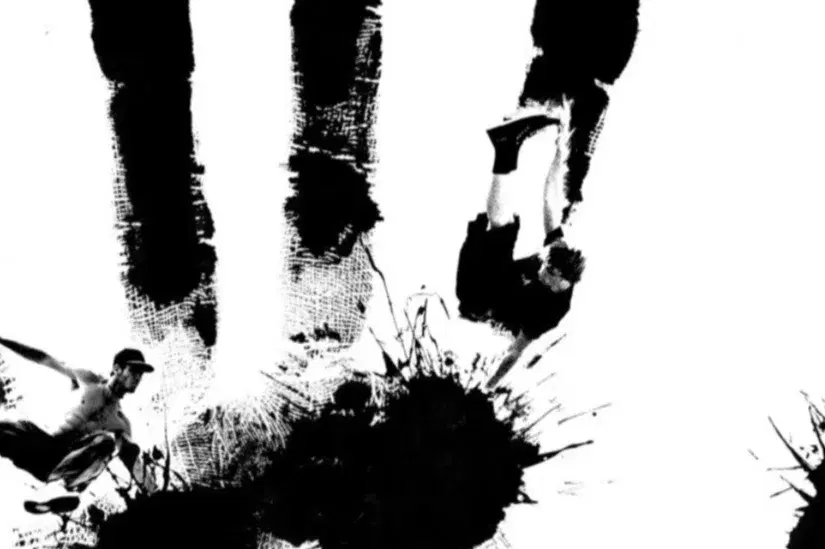 hand surgeon consultation