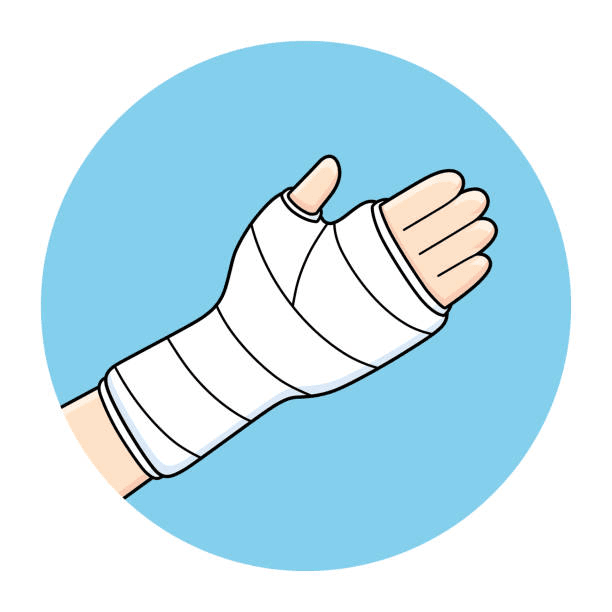 פעולה על גבס, סד או תחבושות