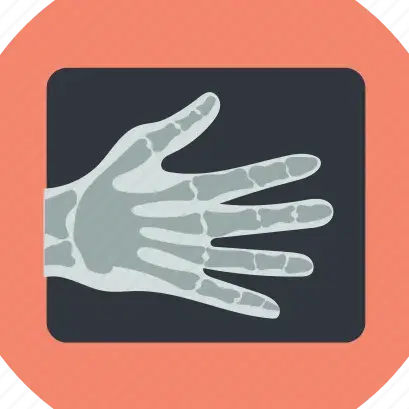 צילום רנטגן